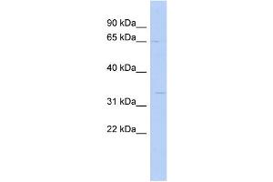 WB Suggested Anti-SC5DL Antibody Titration: 0.