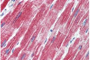 Human Heart (formalin-fixed, paraffin-embedded) stained with TEAD1 antibody ABIN462220 followed by biotinylated goat anti-rabbit IgG secondary antibody ABIN481713, alkaline phosphatase-streptavidin and chromogen. (TEAD1 antibody  (C-Term))