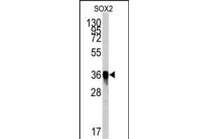 Western blot analysis of SOX2 Antibody (ABIN387798 and ABIN2843854) by SOX2 recombinant protein. (SOX2 antibody)