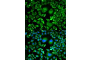 Immunofluorescence analysis of A549 cells using UBE2H antibody. (UBE2H antibody  (AA 1-183))