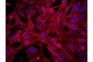 Immunofluorescence (IF) image for anti-CD68 Molecule (CD68) antibody (ABIN2664805) (CD68 antibody)