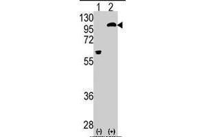 Western blot analysis of PRKCE (arrow) using rabbit PRKCE polyclonal antibody . (PKC epsilon antibody  (AA 213-243))