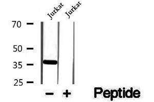 Western blot analysis of extracts of Jurkat cells, using Phospho-CDK6(Tyr24) Antibody.
