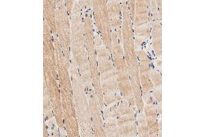 Immunohistochemical analysis of paraffin-embedded human skeletal muscle tissue using (ABIN656961 and ABIN2846145) performed on the Leica® BOND RXm. (CLMP antibody  (AA 81-110))