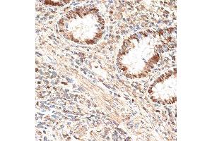 Immunohistochemistry (Paraffin-embedded Sections) (IHC (p)) image for anti-Minichromosome Maintenance Complex Component 5 (MCM5) (AA 1-230) antibody (ABIN6143644)