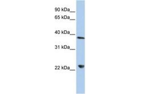 DDX25 antibody  (AA 180-229)