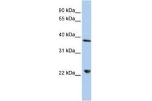 Image no. 1 for anti-DEAD (Asp-Glu-Ala-Asp) Box Polypeptide 25 (DDX25) (AA 180-229) antibody (ABIN6742679) (DDX25 antibody  (AA 180-229))