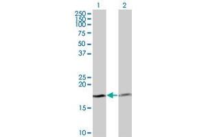 Western Blot analysis of PTH expression in transfected 293T cell line by PTH monoclonal antibody (M12), clone 2A6. (PTH antibody  (AA 32-115))