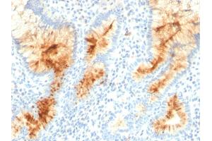 Immunohistochemistry (IHC) image for anti-Mucin 4, Cell Surface Associated (MUC4) (AA 1730-1864) antibody (ABIN6940126)