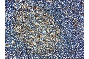 Image no. 8 for anti-IlvB (Bacterial Acetolactate Synthase)-Like (ILVBL) antibody (ABIN1498878)