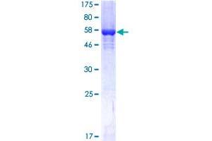 Spermidine Synthase Protein (SRM) (AA 1-302) (GST tag)