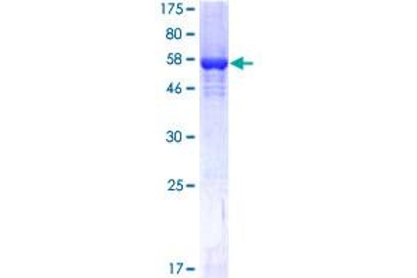 Spermidine Synthase Protein (SRM) (AA 1-302) (GST tag)