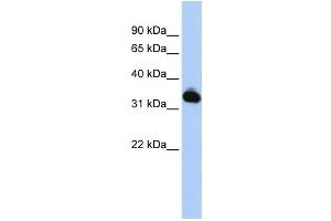 Western Blotting (WB) image for anti-Galactose Mutarotase (Aldose 1-Epimerase) (GALM) antibody (ABIN2459553)