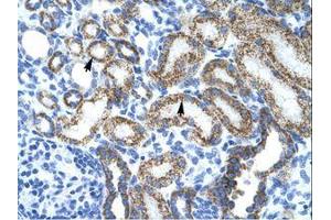 Image no. 1 for anti-Protein L-Myc (MYCL) (AA 135-184) antibody (ABIN202065) (LMYC antibody  (AA 135-184))