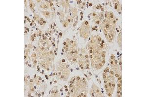 Immunohistochemistry (IHC) image for anti-BMI1 Polycomb Ring Finger Oncogene (BMI1) (AA 120-326) antibody (ABIN3020691)