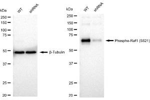 Western blotting analysis using Phospho-Raf1 (S621) antibody (ABIN7800799). (Recombinant RAF1 antibody  (pSer621))