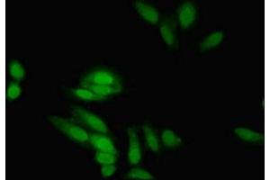 Immunofluorescent analysis of Hela cells using ABIN7152217 at dilution of 1:100 and Alexa Fluor 488-congugated AffiniPure Goat Anti-Rabbit IgG(H+L) (EIF5A2 antibody  (AA 2-153))