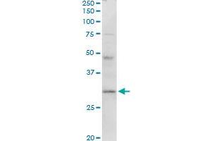 HLA-DMA MaxPab rabbit polyclonal antibody. (HLA-DMA antibody  (AA 1-261))