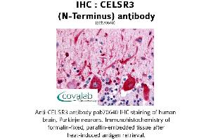 Image no. 1 for anti-Cadherin EGF LAG Seven Pass G-Type Receptor 3 (CELSR3) (Extracellular Domain), (N-Term) antibody (ABIN1732974)