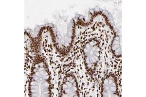 Immunohistochemical staining of human colon with FBXO18 polyclonal antibody  shows strong nuclear positivity in glandular cells at 1:200-1:500 dilution.