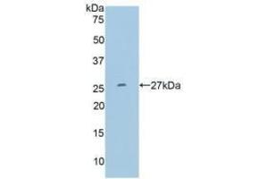 Detection of Recombinant MMP11, Human using Polyclonal Antibody to Matrix Metalloproteinase 11 (MMP11) (MMP11 antibody  (AA 277-488))