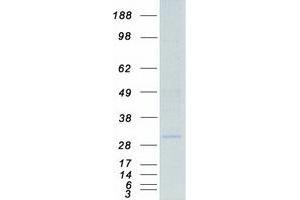 HLA-DQA1 Protein (Myc-DYKDDDDK Tag)