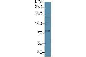 Western Blot; Sample: Human A549 cell lysate; Primary Ab: 2µg/ml Rabbit Anti-Rat ADAMTS5 Antibody Second Ab: 0. (ADAMTS5 antibody  (AA 267-622))