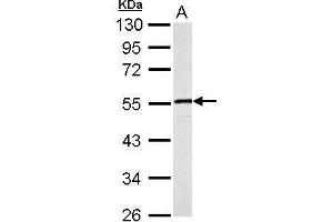 Western Blotting (WB) image for anti-Desmin (DES) antibody (ABIN2855655)