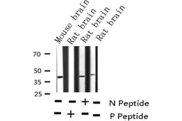 CDC37 antibody  (pSer13)
