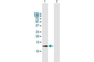 Western Blot analysis of ZSWIM7 expression in transfected 293T cell line by ZSWIM7 MaxPab polyclonal antibody.