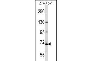 ZN Antibody (N-term ) (ABIN657582 and ABIN2846585) western blot analysis in ZR-75-1 cell line lysates (35 μg/lane). (ZNF135 antibody  (N-Term))