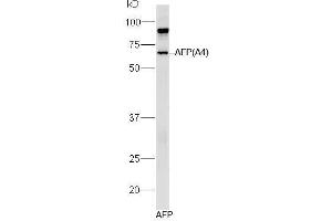 Human AFP lysates probed with Mouse Anti-AFP (A4) Monoclonal Antibody, Unconjugated (bsm-1622M) at 1:300 overnight at 4˚C. (alpha Fetoprotein antibody)