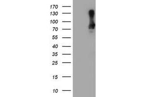 Western Blotting (WB) image for anti-SAM Domain and HD Domain 1 (SAMHD1) antibody (ABIN1500798) (SAMHD1 antibody)
