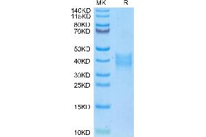 Oncostatin M Protein (OSM) (AA 25-206) (His tag)