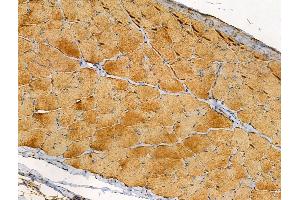 ABIN6257147 and ABIN6274445 at 1/100 staining Rat skin tissue by IHC-P.
