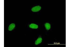Immunofluorescence of monoclonal antibody to YAP1 on HeLa cell. (YAP1 antibody  (AA 53-161))
