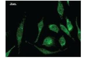 Immunostaining analysis in HeLa cells. (MOB2 antibody)