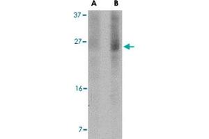 Western blot analysis of BBC3 expression in K-562 cell lysate with BBC3 monoclonal antibody, clone 2A9G5  at (A) 2.