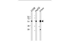 All lanes : Anti-UGP2 Antibody (C-term) at 1:2000 dilution Lane 1:  whole cell lysate Lane 2: HepG2 whole cell lysate Lane 3: Human liver lysate Lysates/proteins at 20 μg per lane. (UGP2 antibody  (C-Term))