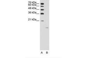 Image no. 2 for anti-Acid Phosphatase 1, Soluble (ACP1) (AA 21-70) antibody (ABIN203506) (ACP1 antibody  (AA 21-70))