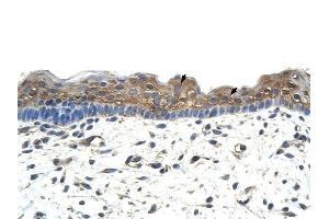 ApoBEC2 antibody was used for immunohistochemistry at a concentration of 4-8 ug/ml to stain Squamous epithelial cells (arrows) in Human Skin.
