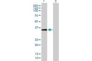 Western Blot analysis of AKTIP expression in transfected 293T cell line by AKTIP MaxPab polyclonal antibody. (AKTIP antibody  (AA 1-292))