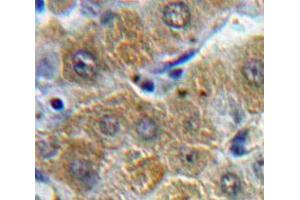 Used in DAB staining on fromalin fixed paraffin-embedded Liver tissue (ORM1 antibody  (AA 19-201))