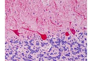 Human Cerebellum: Formalin-Fixed, Paraffin-Embedded (FFPE) (CARD11 antibody)