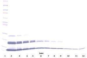Image no. 3 for anti-Chemokine (C-X-C Motif) Ligand 16 (CXCL16) antibody (ABIN465413) (CXCL16 antibody)