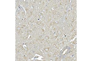 Immunohistochemistry of paraffin-embedded mouse spinal cord using IL11RA Rabbit mAb (ABIN7267984) at dilution of 1:150 (40x lens). (IL11RA antibody)