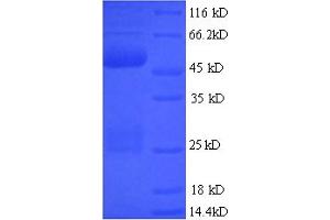 SDS-PAGE (SDS) image for ERG, ETS transcription factor (ERG) (AA 1-486), (full length) protein (His tag) (ABIN5713436) (ERG Protein (AA 1-486, full length) (His tag))