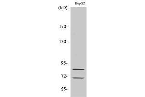 Western Blotting (WB) image for anti-Choline O-Acetyltransferase (CHAT) (Internal Region) antibody (ABIN3183908) (Choline Acetyltransferase antibody  (Internal Region))