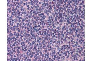 Immunohistochemistry (IHC) image for anti-Promyelocytic Leukemia (PML) (C-Term) antibody (ABIN2777721)