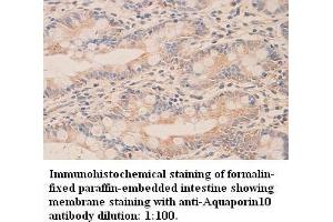 Image no. 1 for anti-Aquaporin 10 (AQP10) (C-Term) antibody (ABIN791001) (Aquaporin 10 antibody  (C-Term))